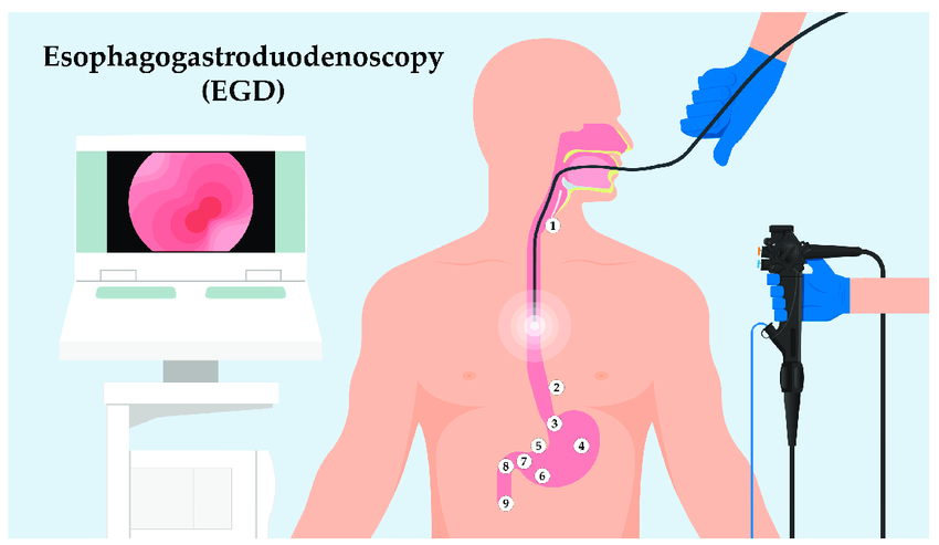 The Importance of Endoscopy in Gastrointestinal Care
