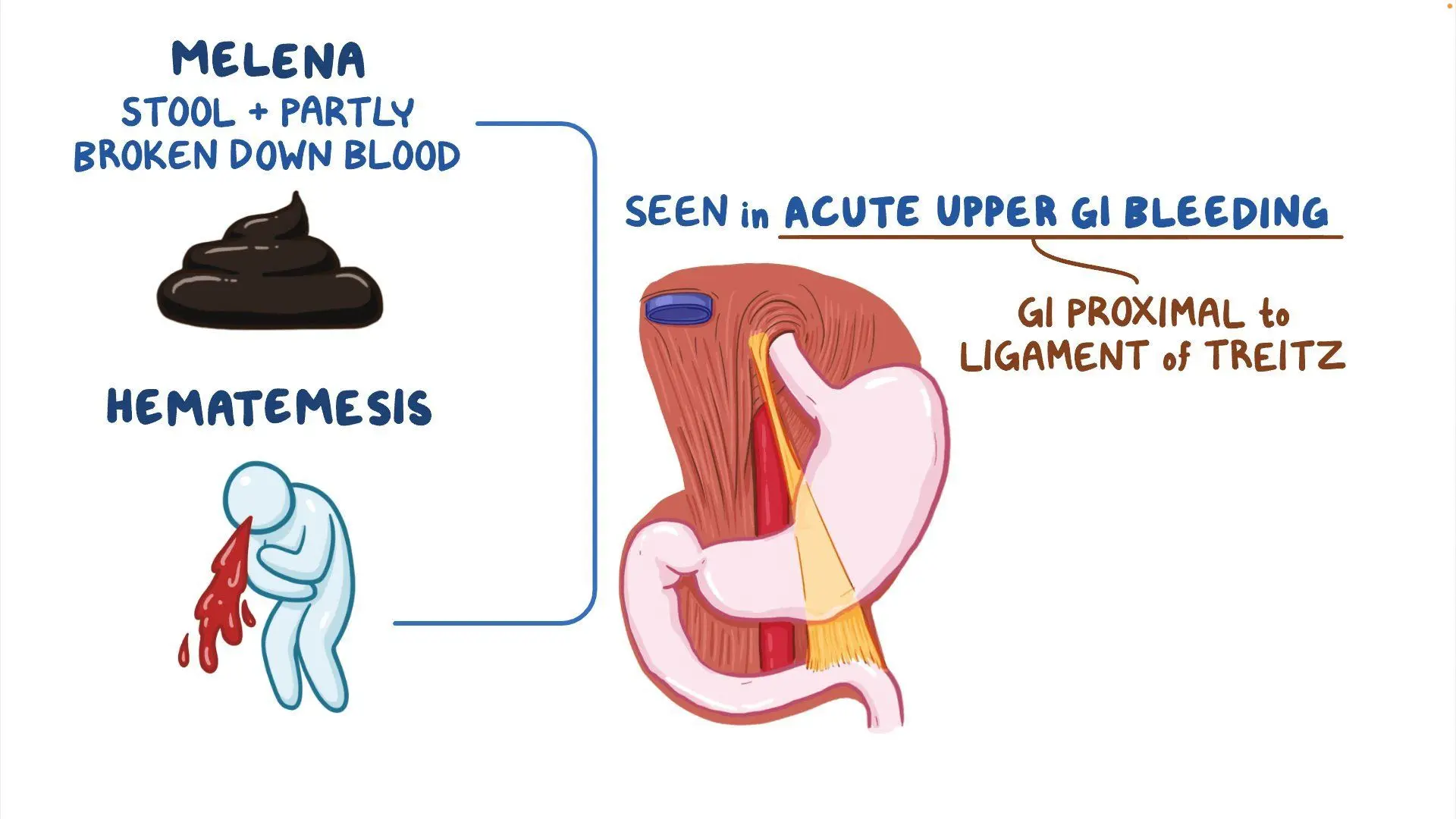 Understanding Haematemesis and Bleeding Per Rectum