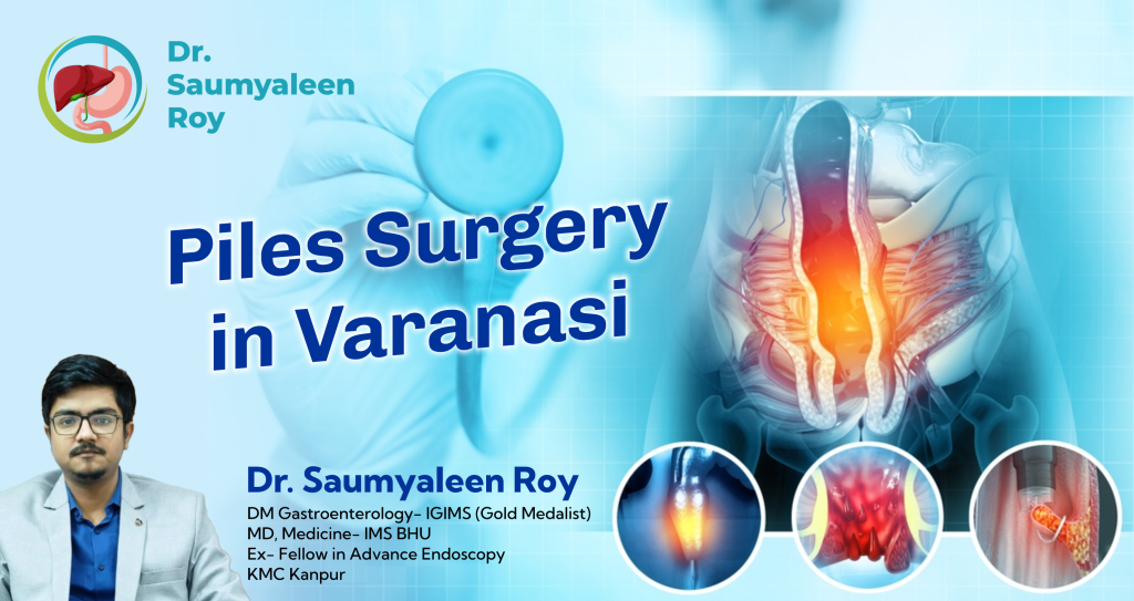 Piles Surgery in Varanasi: A Comprehensive Guide