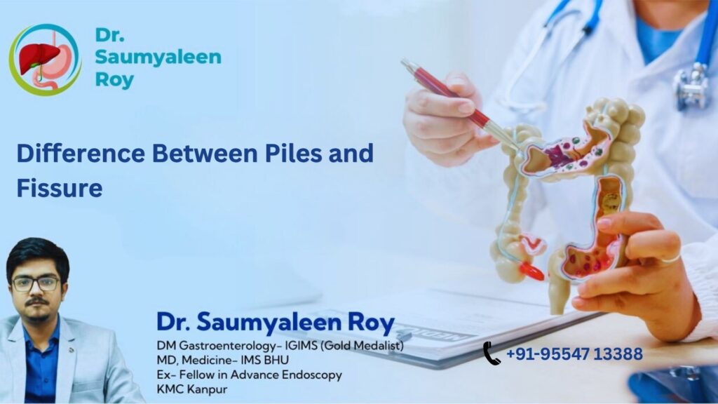 Difference Between Piles and Fissure: Symptoms, Causes, Diagnosis and Treatment